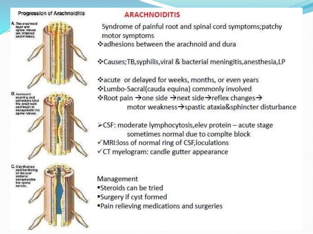 Compressive myelopathy - Etiology, Pathogenesis, Clinical Features ...