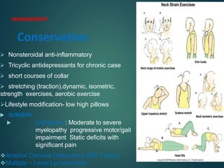 Compressive Myelopathy.pptx