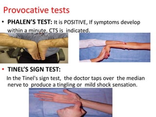 Provocative tests
• PHALEN’S TEST: It is POSITIVE, If symptoms develop
within a minute, CTS is indicated.
• TINEL’S SIGN TEST:
In the Tinel's sign test, the doctor taps over the median
nerve to produce a tingling or mild shock sensation.
 