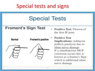 Special tests and signs
 