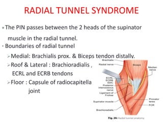 RADIAL TUNNEL SYNDROME
The PIN passes between the 2 heads of the supinator
muscle in the radial tunnel.
• Boundaries of radial tunnel
Medial: Brachialis prox. & Biceps tendon distally.
Roof & Lateral : Brachioradialis ,
ECRL and ECRB tendons
Floor : Capsule of radiocapitellar
joint
 