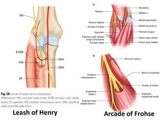 Leash of Henry Arcade of Frohse
 