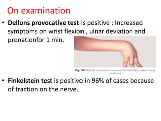 On examination
• Dellons provocative test is positive : Increased
symptoms on wrist flexion , ulnar deviation and
pronationfor 1 min.
• Finkelstein test is positive in 96% of cases because
of traction on the nerve.
 