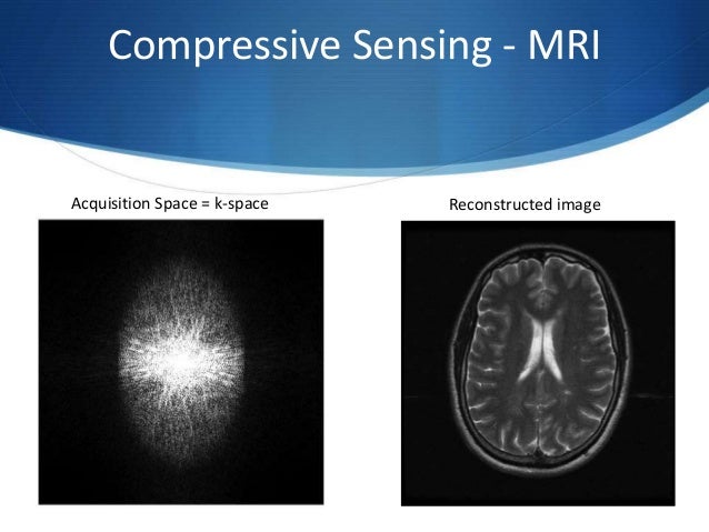 Compressive Sensing Mri : Compressed sensing MRI: a review – FKVCJV