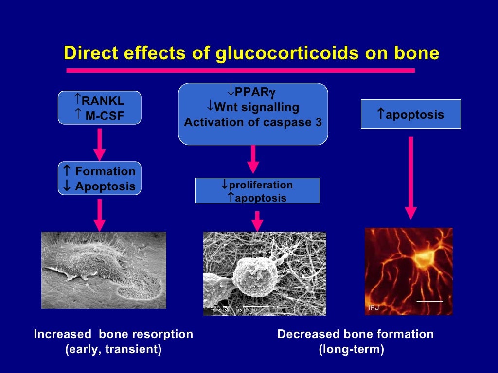 Druginduced Osteoporosis