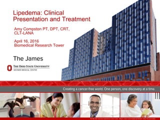 The Ohio State University Comprehensive Cancer Center – Arthur G. James Cancer Hospital and Richard J. Solove Research Institute
Lipedema: Clinical
Presentation and Treatment
Amy Compston PT, DPT, CRT,
CLT-LANA
April 16, 2016
Biomedical Research Tower
 