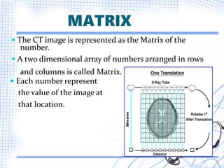 Computed Tomography and Spiral Computed Tomography | PPTX