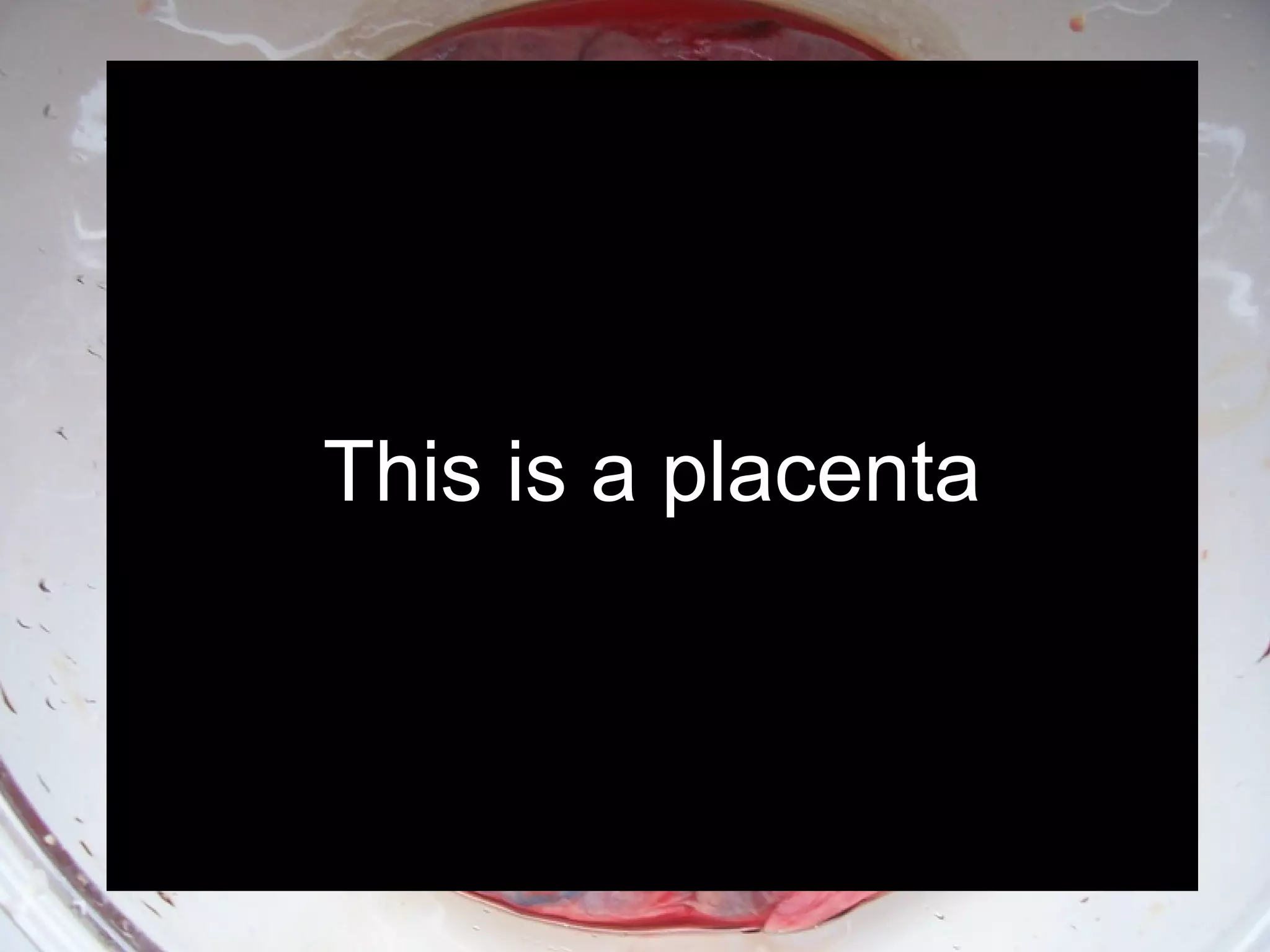 This is a placenta
 