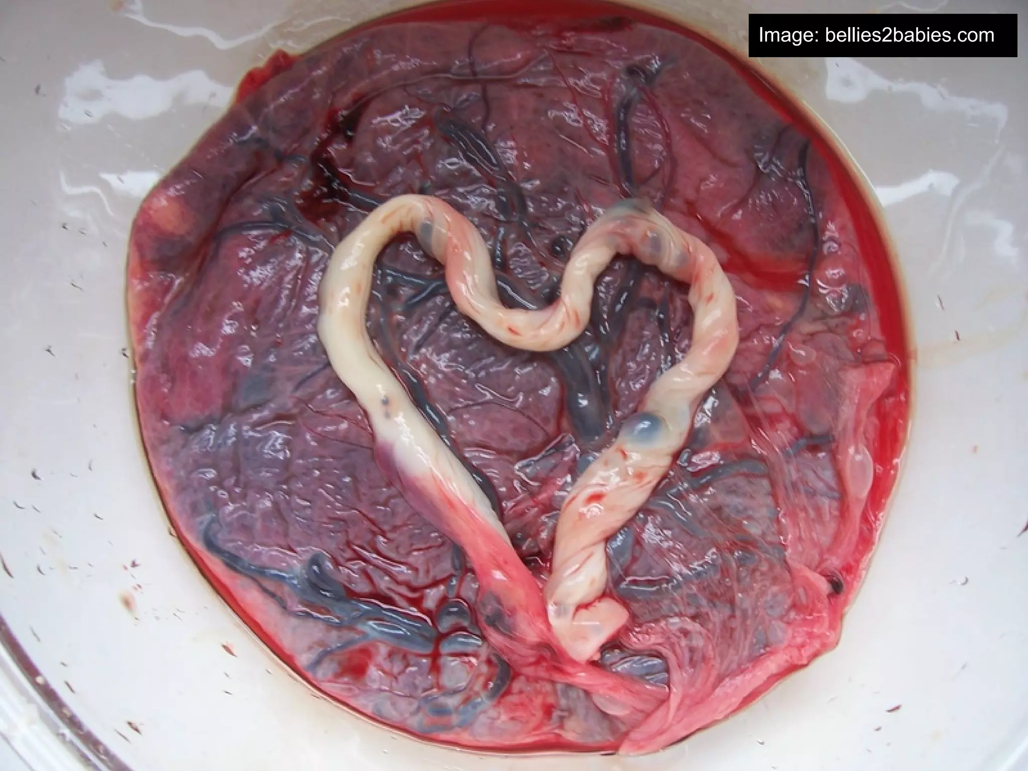 Image: bellies2babies.com
 