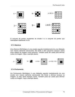 Prof Kesede R Julio
O conjunto de pontos resultantes da erosão é a o conjunto de pontos que
interceptam totalmente A e B.
5.7.3 Abertura
Uma Abertura Morfológica é uma erosão seguida imediatamente de uma dilatação
com mesmo elemento estruturante. Ela tende a abrir pequenos espaços vazios
entre objetos da imagem muito próximos. Também pode ser usada para eliminar
ruídos na imagem. Veja o exemplo abaixo.
5.7.4 Fechamento
Um Fechamento Morfológico é uma dilatação seguida imediatamente de uma
erosão com mesmo elemento estruturante. Ele tende a eliminar buracos na
imagem, ou seja, fecha espaços vazios. Também pode ser usada para eliminar
ruídos na imagem. Veja o exemplo abaixo.
Computação Gráfica e Processamento de Imagem 74
 