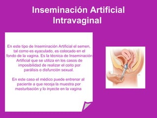 Inseminación Artificial
Intravaginal
En este tipo de Inseminación Artificial el semen,
tal como es eyaculado, es colocado en el
fondo de la vagina. Es la técnica de Inseminación
Artificial que se utiliza en los casos de
imposibilidad de realizar el coito por
parálisis o disfunción sexual.
En este caso el médico puede entrenar al
paciente a que recoja la muestra por
masturbación y lo inyecte en la vagina
 