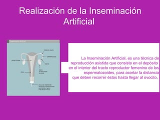 Realización de la Inseminación
Artificial
La Inseminación Artificial, es una técnica de
reproducción asistida que consiste en el depósito
en el interior del tracto reproductor femenino de los
espermatozoides, para acortar la distancia
que deben recorrer éstos hasta llegar al ovocito.
 