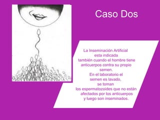 Caso Dos
La Inseminación Artificial
esta indicada
también cuando el hombre tiene
anticuerpos contra su propio
semen.
En el laboratorio el
semen es lavado,
se toman
los espermatozoides que no están
afectados por los anticuerpos
y luego son inseminados.
 