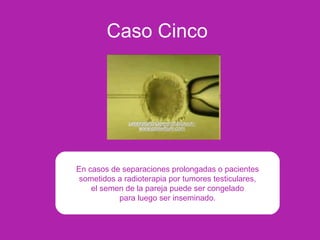 Caso Cinco
En casos de separaciones prolongadas o pacientes
sometidos a radioterapia por tumores testiculares,
el semen de la pareja puede ser congelado
para luego ser inseminado.
 