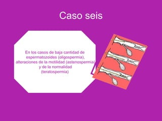 Caso seis
En los casos de baja cantidad de
espermatozoides (oligospermia),
alteraciones de la motilidad (astenospermia)
y de la normalidad
(teratospermia)
 