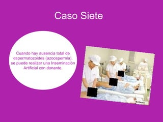 Caso Siete
Cuando hay ausencia total de
espermatozoides (azoospermia),
se puede realizar una Inseminación
Artificial con donante.
 