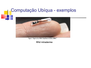 Computação Ubíqua - exemplos
Rfid intraderme
 