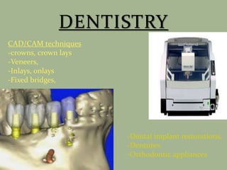 CAD/CAM techniques
-crowns, crown lays
-Veneers,
-Inlays, onlays
-Fixed bridges,
-Dental implant restorations,
-Dentures
-Orthodontic appliances
 