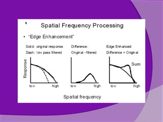 Computed radiography | PPT