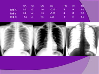 Computed radiography | PPT