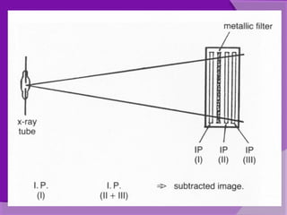 Computed radiography | PPT