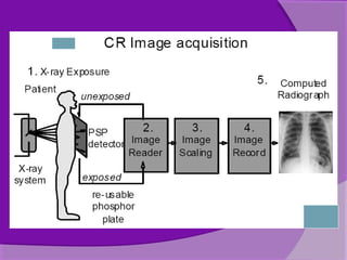 First Computed Radiography Computed radiography | PPT
