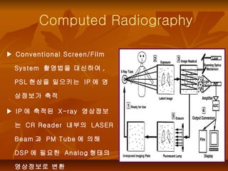 Conventional Radiography Screen Computed radiography &digital radiography | PPT