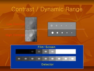 Contrast / Dynamic Range Low Contrast High Contrast Film-Screen Detector 