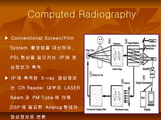 Computed Radiography ▶  Conventional Screen/Film System  촬영법을 대신하여 , PSL 현상을 일으키는  IP 에 영상정보가 축적 ▶  IP 에 축적된  X-ray  영상정보는...