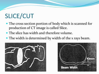 SLICE/CUT
 The cross section portion of body which is scanned for
production of CT image is called Slice.
 The slice has width and therefore volume.
 The width is determined by width of the x rays beam.
 