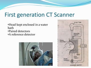 First generation CT Scanner
•Head kept enclosed in a water
bath
•Paired detectors
•A reference detector
 