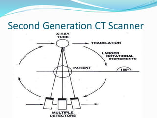 Second Generation CT Scanner
 