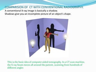 COMPARISION OF CT WITH CONVIENTIONAL RADIOGRAPHY.
A conventional X-ray image is basically a shadow.
Shadows give you an incomplete picture of an object's shape.
This is the basic idea of computer aided tomography. In a CT scan machine,
the X-ray beam moves all around the patient, scanning from hundreds of
different angles
 