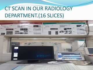 CT SCAN IN OUR RADIOLOGY
DEPARTMENT.(16 SLICES)
 