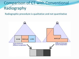 Comparison of CT with Conventional
Radiography
Radiographic procedure is qualitative and not quantitative
 