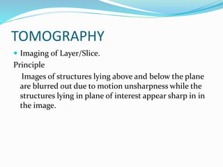 TOMOGRAPHY
 Imaging of Layer/Slice.
Principle
Images of structures lying above and below the plane
are blurred out due to motion unsharpness while the
structures lying in plane of interest appear sharp in in
the image.
 