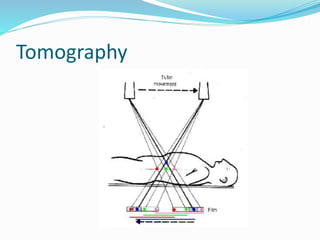 Tomography
 