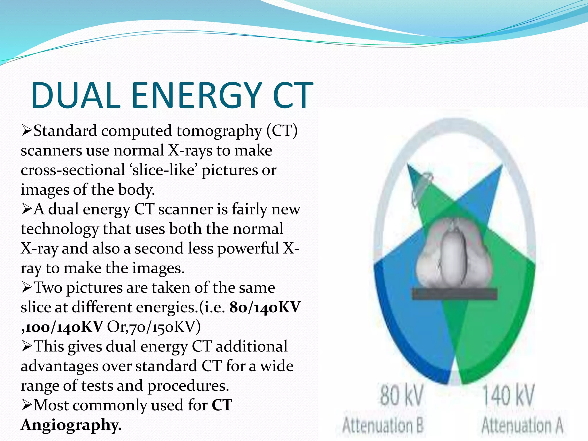 Computed tomography | PPTX