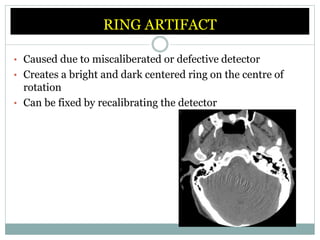 computed tomography.pptx
