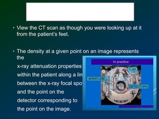 • View the CT scan as though you were looking up at it
from the patient’s feet.
• The density at a given point on an image represents
the
x-ray attenuation properties
within the patient along a line
between the x-ray focal spot
and the point on the
detector corresponding to
the point on the image.
 