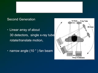 Second Generation
• Linear array of about
30 detectors, single x-ray tube,
rotate/translate motion,
• narrow angle (10 ° ) fan beam
 