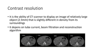 Computed tomography - Physics and Clinical | PPT