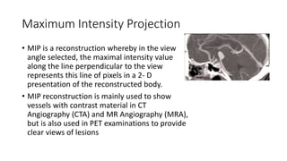 Computed tomography - Physics and Clinical | PPT