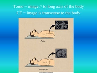 Tomo = image // to long axis of the body
CT = image is transverse to the body
 