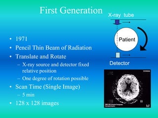 First Generation
• 1971
• Pencil Thin Beam of Radiation
• Translate and Rotate
– X-ray source and detector fixed
relative position
– One degree of rotation possible
• Scan Time (Single Image)
– 5 min
• 128 x 128 images
Patient
X-ray tube
Detector
 