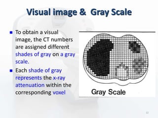 Visual image & Gray Scale
 To obtain a visual
image, the CT numbers
are assigned different
shades of gray on a gray
scale.
 Each shade of gray
represents the x-ray
attenuation within the
corresponding voxel
12
 