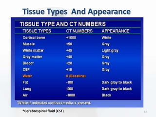 13
Tissue Types And Appearance
*Cerebrospinal fluid (CSF)
 