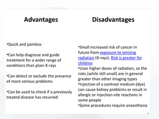 Advantages
•Quick and painless
•Can help diagnose and guide
treatment for a wider range of
conditions than plain X-rays
•Can detect or exclude the presence
of more serious problems
•Can be used to check if a previously
treated disease has recurred
Disadvantages
•Small increased risk of cancer in
future from exposure to ionising
radiation (X-rays). Risk is greater for
children
•Uses higher doses of radiation, so the
risks (while still small) are in general
greater than other imaging types
•Injection of a contrast medium (dye)
can cause kidney problems or result in
allergic or injection-site reactions in
some people
•Some procedures require anaesthesia
37
 