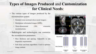 Tomography Types Computed Tomography Equipments.pptx