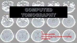 By:
T.Antony godson,
M.sc radiology and imaging technology.
(Integrated)
 
